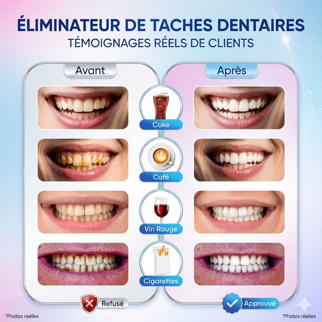 ✨Révélez la blancheur naturelle de votre sourire dès aujourd’hui !
